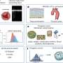 Improving diagnosis of aortic stenosis with genetics and AI